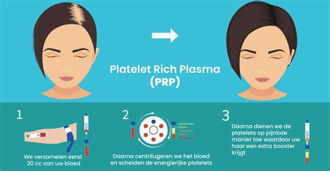 PRP Behandeling Haar: Is Het De Juiste Keuze?