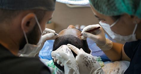 Vergelijking Van De Populaire Haartransplantatie Methoden
